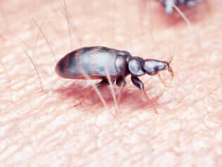 bed bug removal services